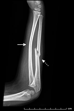 儿童简单外伤的处理方法,如何讲解儿童外伤处理小常识