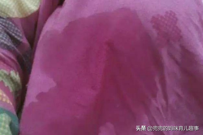 产后涨奶用三种有效的缓解方法,产后涨奶不管它会怎么样