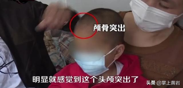 湖南郴州大头娃娃奶粉事件,郴州大头娃娃奶粉真的假的