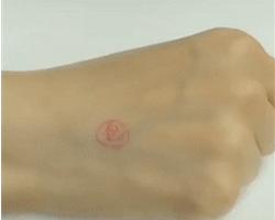 炉甘石治疗手痒正确用法,炉甘石洗剂老年人瘙痒