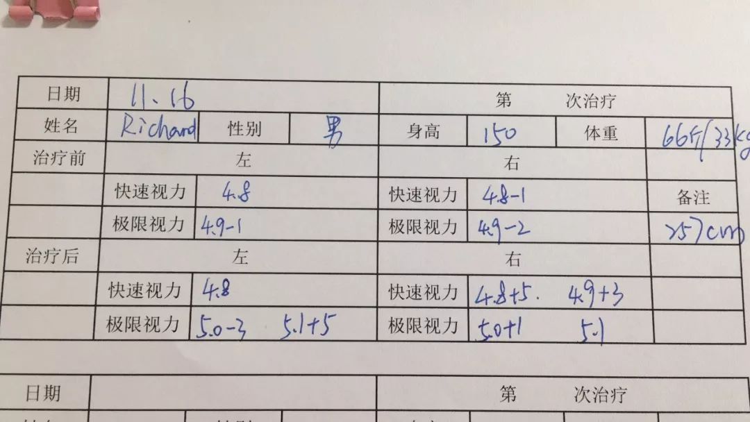 孩子20度斜视加近视,孩子100度近视又有斜视如何挽救