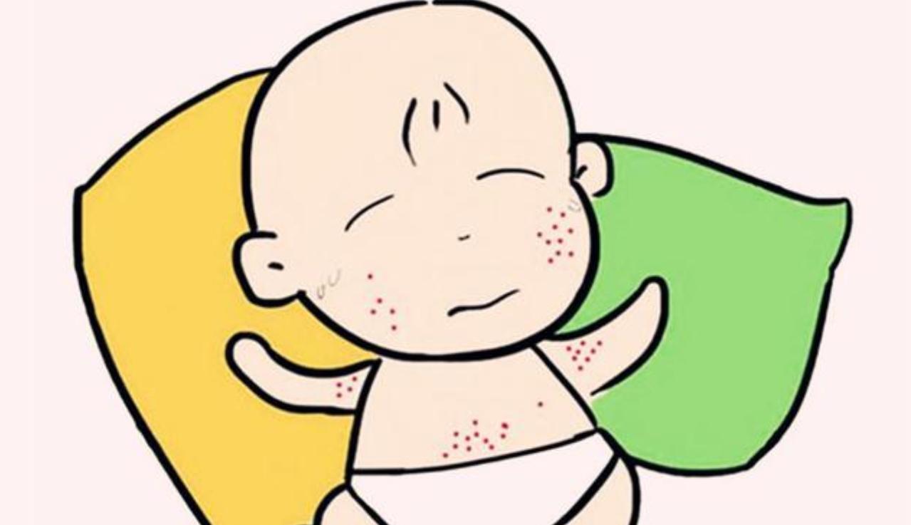 宝宝起疹子的症状有哪些,宝宝起疹子跟孕妈吃东西有关么