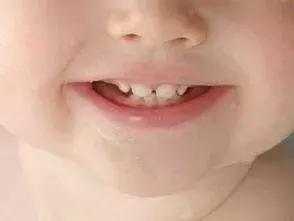 宝宝长乳牙关注事项及禁忌,一定要关注孩子的乳牙很重要