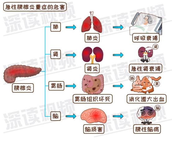 急性胰腺炎科普文章800字,急性胰腺炎护理论文