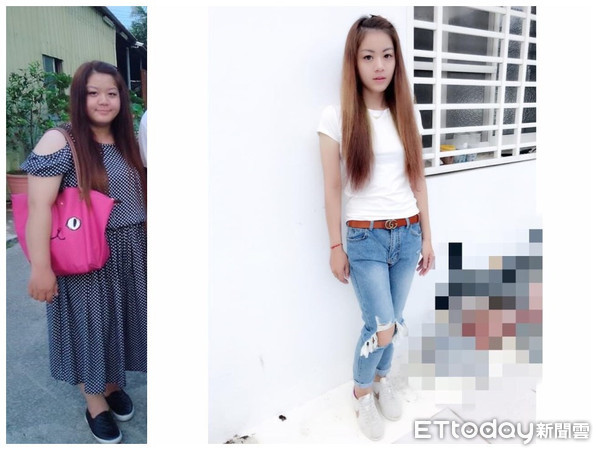 重度肥胖很快减肥后的变化,肥胖引起的血汗管疾病