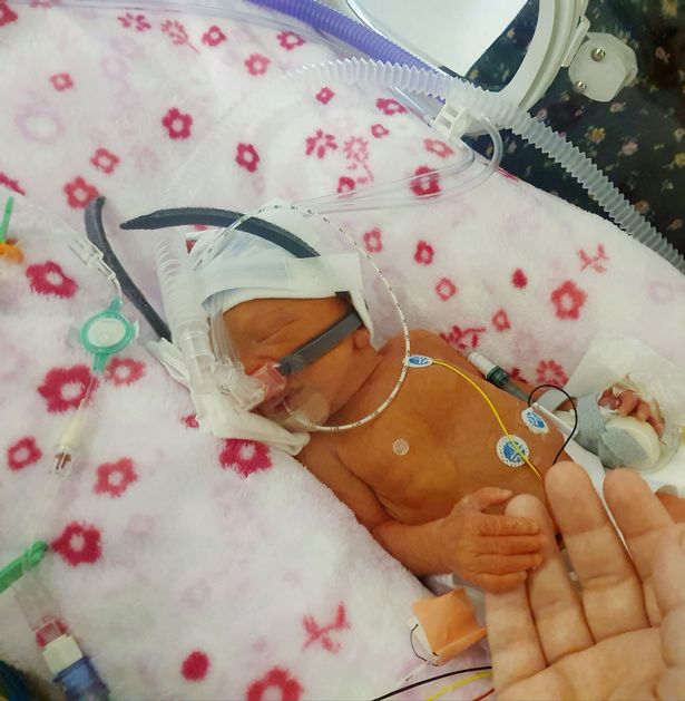 英孕妇怀孕不足4月羊水即破，本欲办葬礼，最终奇迹产子