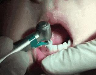 上牙埋地下，下牙扔房顶，孩子乳牙掉了别再这么做了