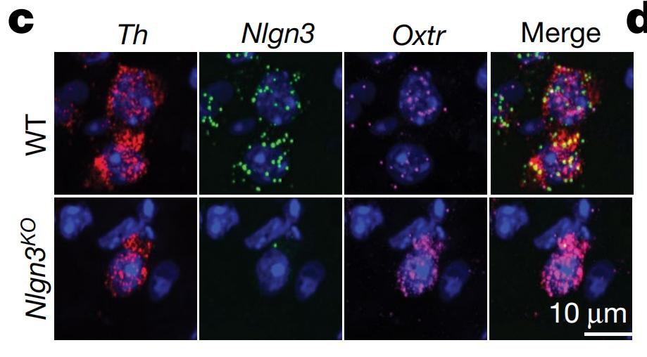 最新研究揭示导致自闭症的新基因突变，为拯救自闭症带来新希望