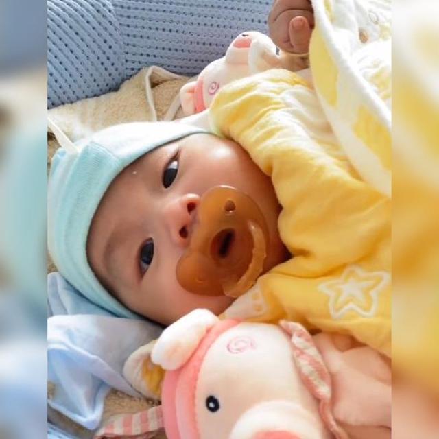 2个半月防止宝宝抓脸妙招,用什么方法可以有效阻止婴儿抓脸