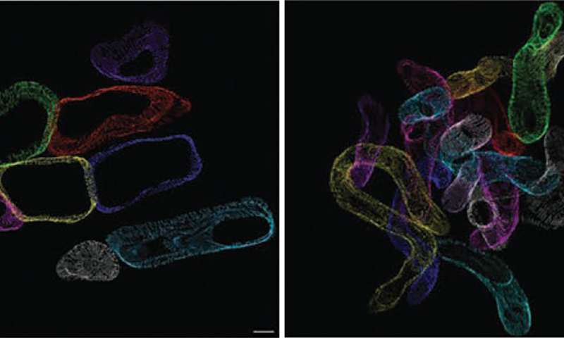 脂肪细胞对心脏的影响,饱和脂肪对心脏健康的影响