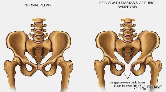 产后妈妈十大疼痛，哪一个你中招了？