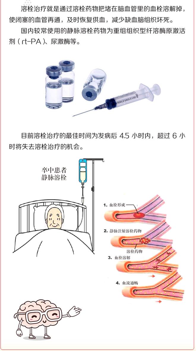 卒中预防知识讲座,预防为主远离卒中