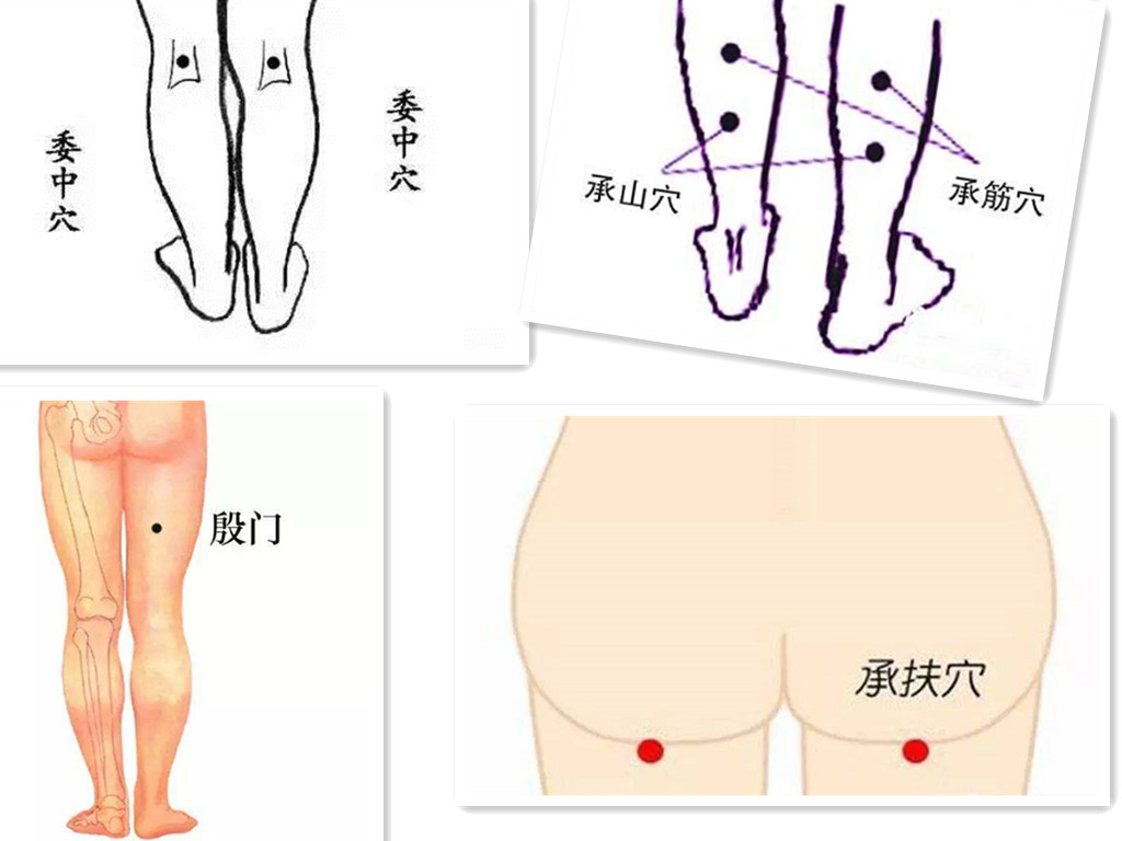 坐骨神经痛起不了床怎么办呢,坐骨神经痛怎么治疗有哪些偏方