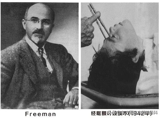 精神病人的前世,精神科药物的前世今生