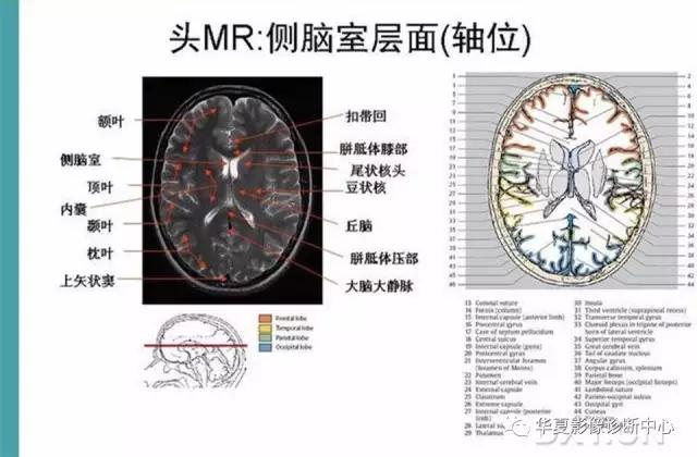 mra头颅解剖学详细讲解视频,常见的头颅mri图像