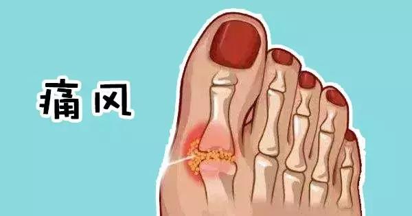 脚趾关节刺痛是怎么回事,关节活动受限用什么药
