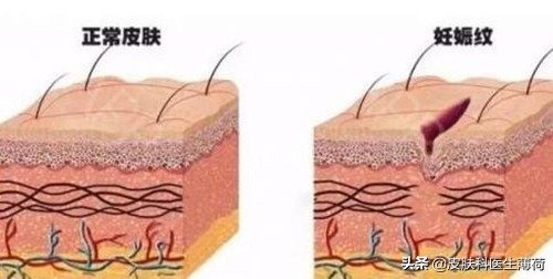 妊娠与皮肤|怀孕后爆痘、瘙痒、长斑，药膏、护肤品还能用吗？