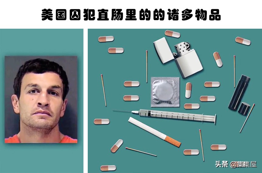 在人体内发现的6个难以用常理解释的物体