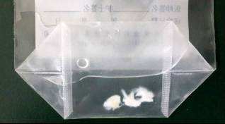 半月板缝合有必要切除滑膜吗,半月板缝合和半月板切除哪个严重