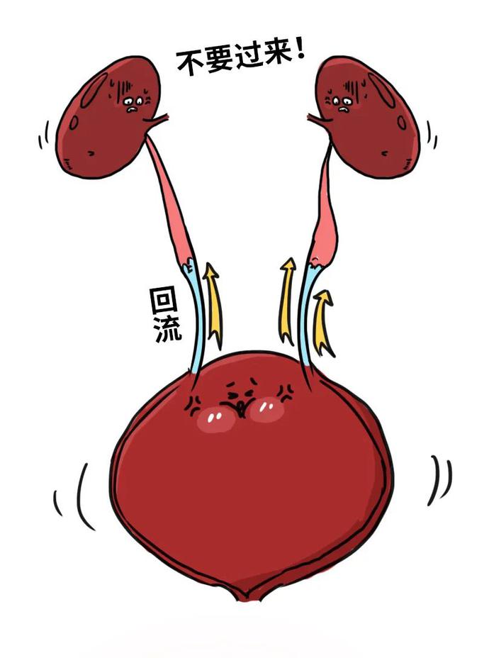 睡觉尿憋回去是怎么回事,憋回去的尿最终会从哪里排出来