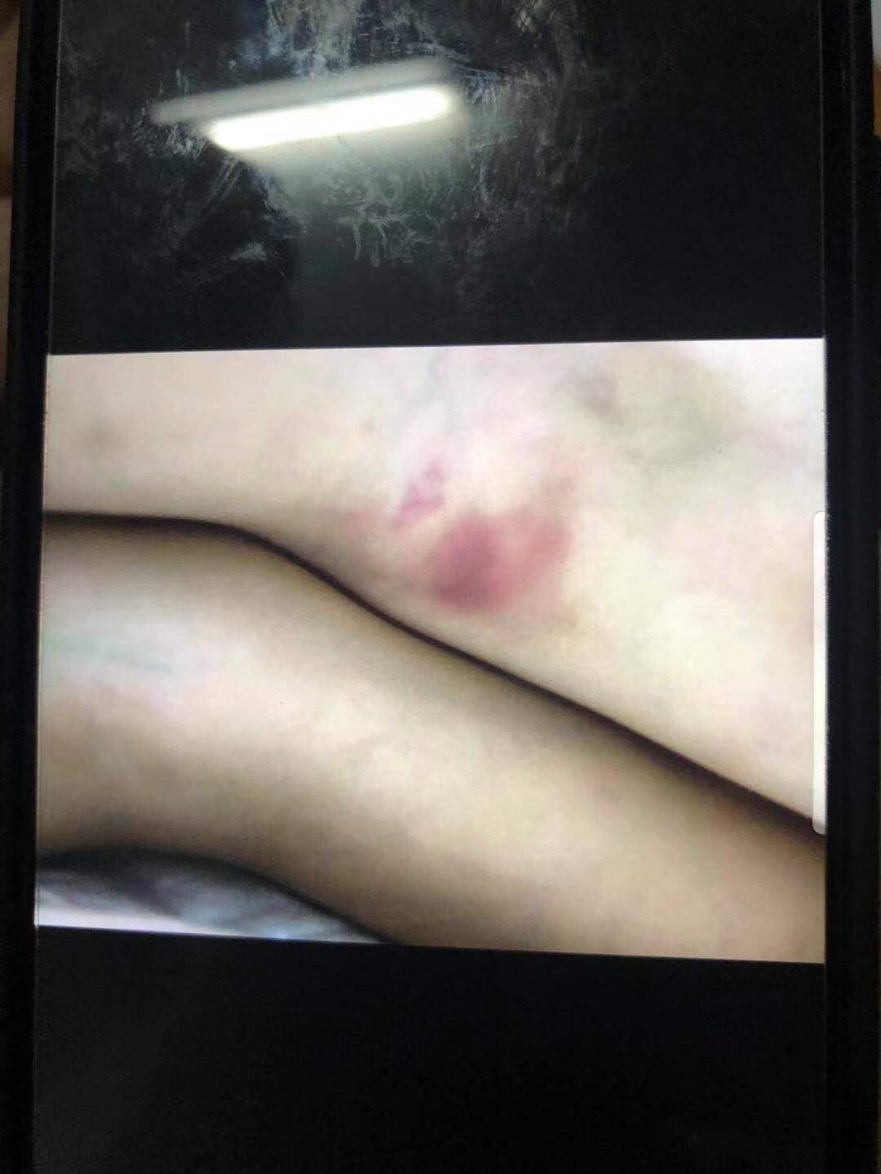 7岁男孩习武被教练击死,7岁男童武校身亡涉事教练被判6年