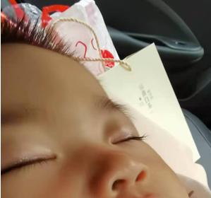 一岁多宝宝霰粒肿康复过程全纪录