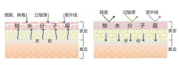 抗敏修复护肤,干敏皮抗衰护肤知识