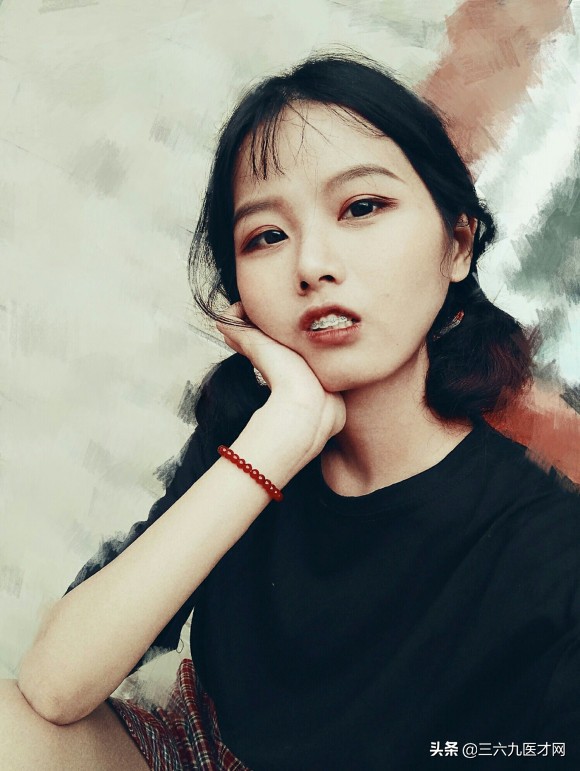 龅牙矫正成功的图片对比,2周岁龅牙可以矫正吗