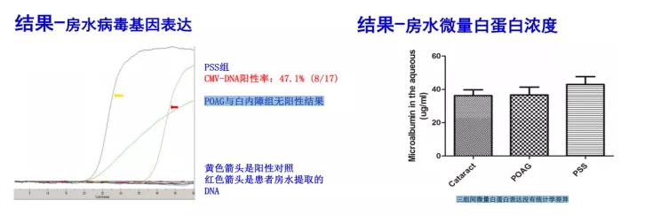 孙兴怀青睫综合症,孙兴怀谈ucp治疗青光眼