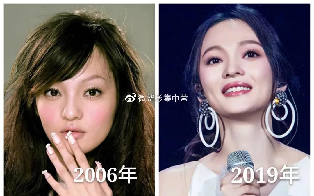 明星网红种草的抗糖丸，真的有用吗？