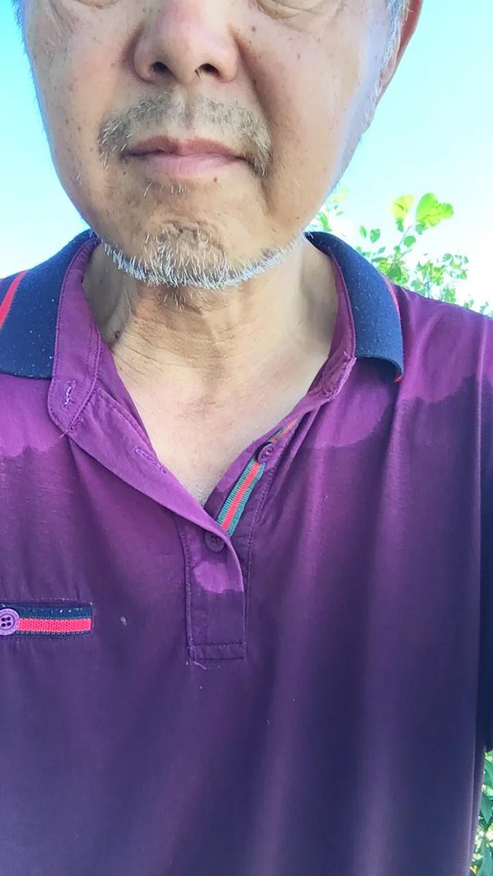 有过脑梗病史的人,有脑梗的人每年疏通一次血管吗