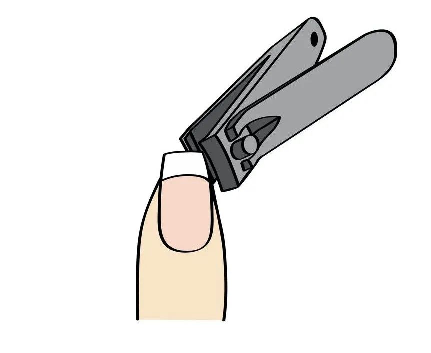 指甲出现白线月牙型的是怎么回事,指甲发白有竖纹是身体缺什么