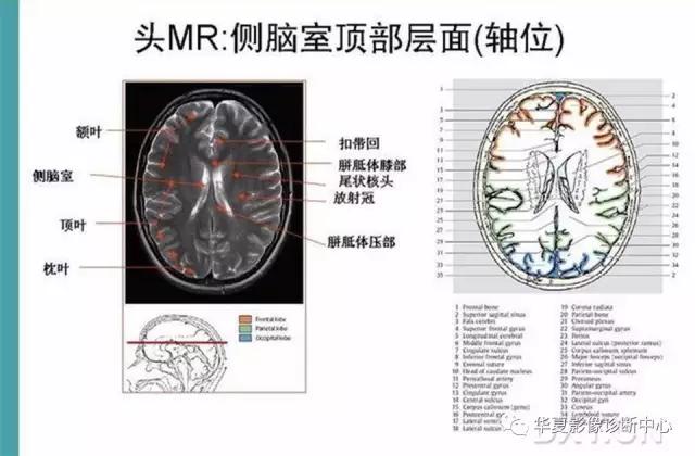 mra头颅解剖学详细讲解视频,常见的头颅mri图像