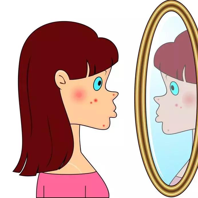 范瑞强治痘痘厉害真的还是假的,中年女性青春痘