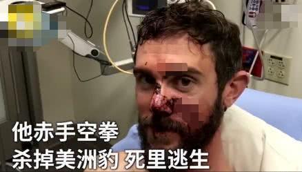 你这一胳膊肘下去，对方的头骨都可能会被干裂？硬核分析不容错过