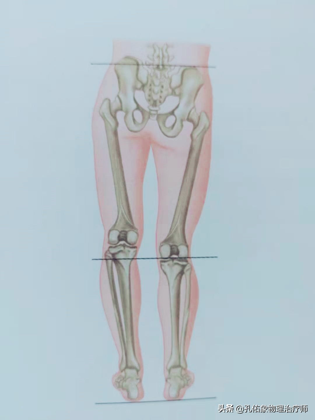 久坐右边臀部疼痛发麻怎么锻炼,久坐臀部疼痛怎么锻炼