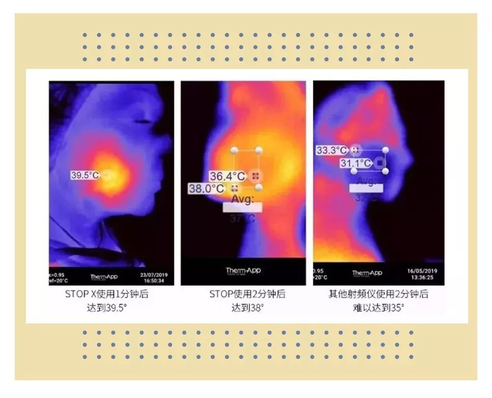 tripollarstop美容仪真假测评,tripollarstopeye测评