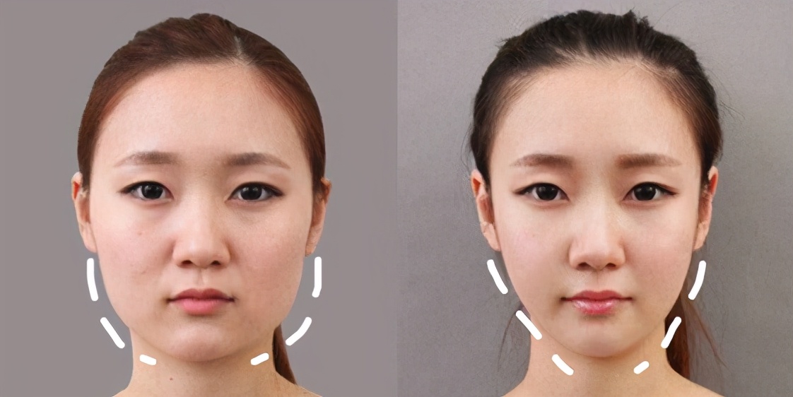 梦禾精华套盒,梦禾效果怎么样