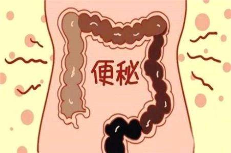 便秘都是上火吗？教你正确使用通便的中成药！