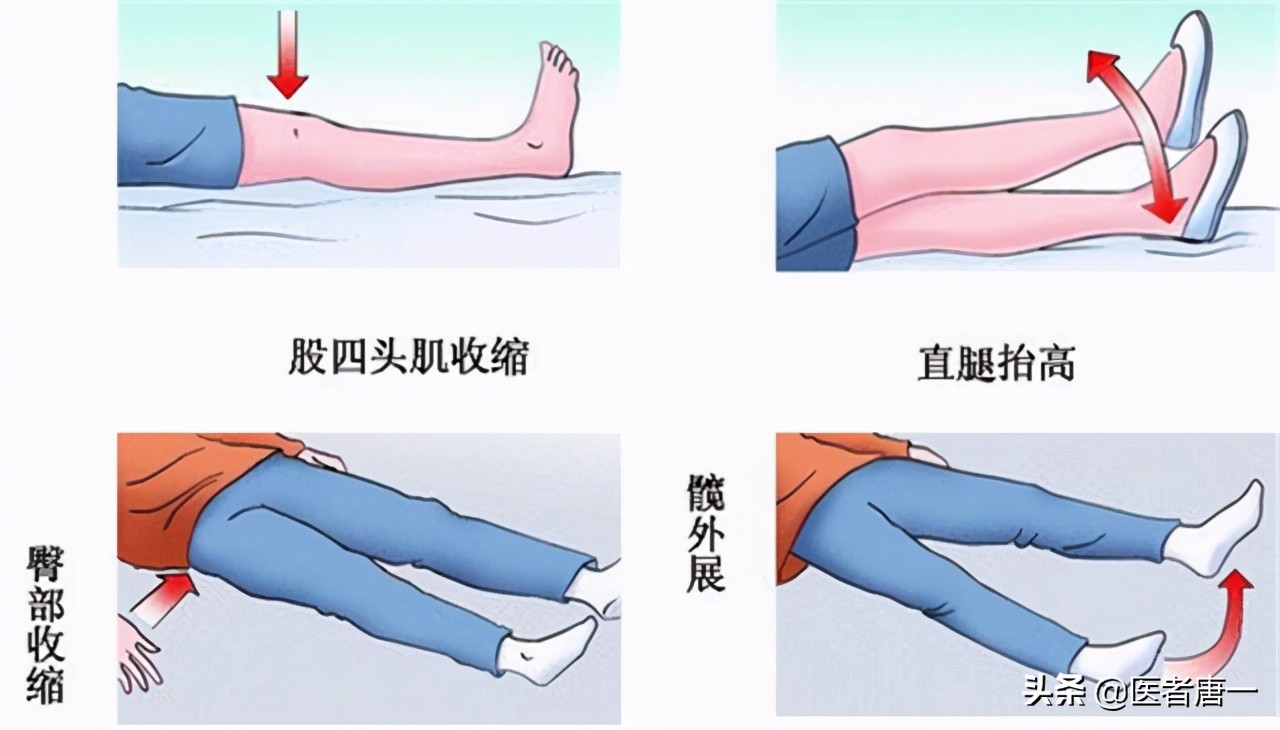 上下楼梯膝盖疼是髌骨软化吗,髌骨外倾导致疼痛怎么办