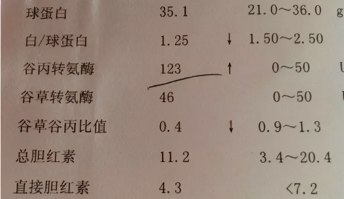 转氨酶升高的七大原因华医网答案,转氨酶升高的原因及解决方法