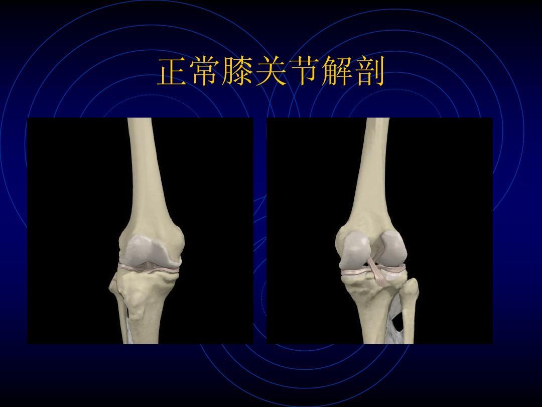 膝关节脱位可以正骨吗,膝关节脱位多长时间做手术最佳