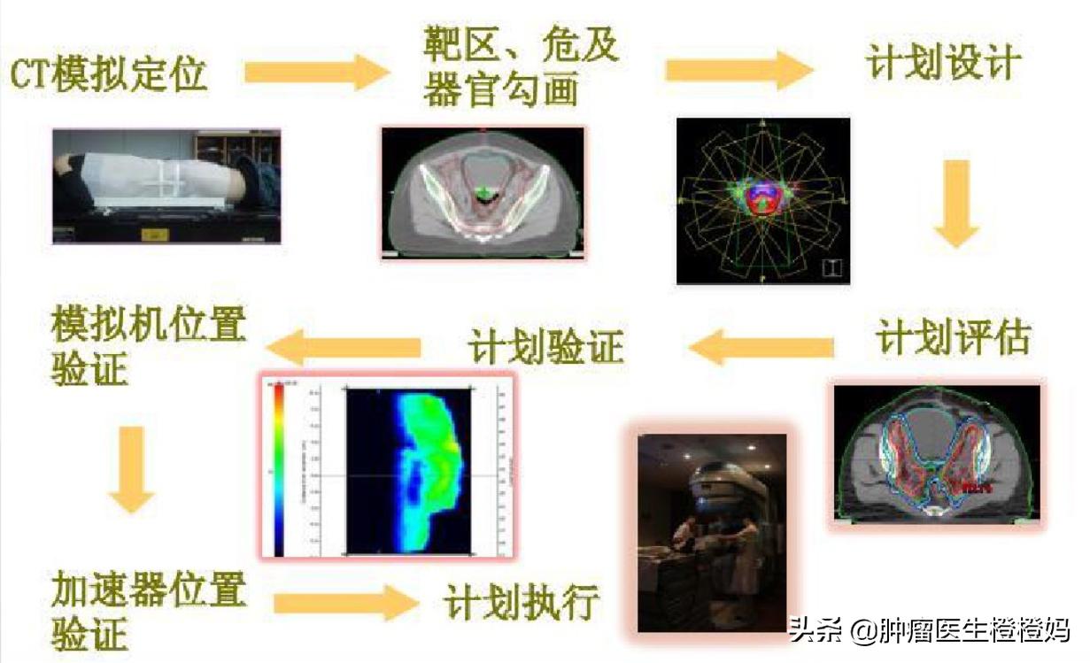 怎么区分放疗需要三维还是二维,化疗放疗的误区