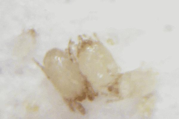 鼻头痘痘爆浆,鼻头痘痘挤出来的白色物质是什么