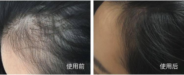 外用中药眼膜,中药眼膜去眼袋眼纹