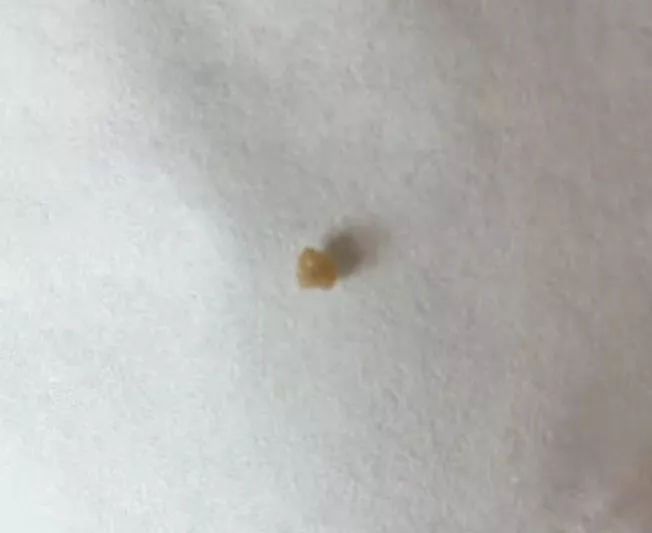 闭着嘴巴都感觉口腔有异味,闭着嘴巴嘴巴里有一股臭味