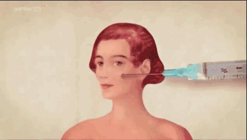 医美微针有什么效果,配合微针做的医美产品有哪些