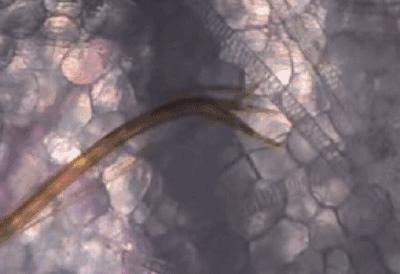 被蚊子咬了特别痒怎么快速止痒,被蚊子咬了痒怎么快速止痒