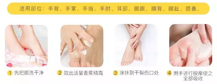 手脚冻疮怎么治断根,冬季治手脚干裂冻疮有效的药