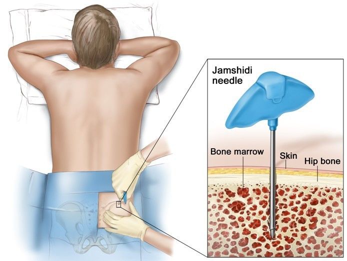 医生不可以做的事,血液科一般都做哪些检查呢